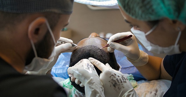 Hvad kan du forvente af en hårtransplantation? En personlig beretning